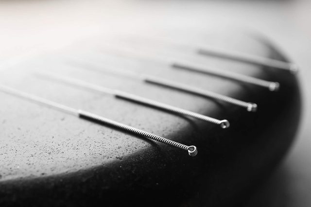 Acupuncture
