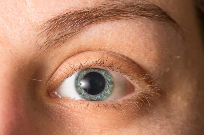 Blue eye with dilated pupil