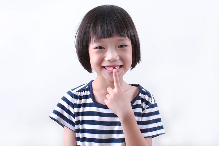 Cute asian girl missing front tooth pointing at it with her finger