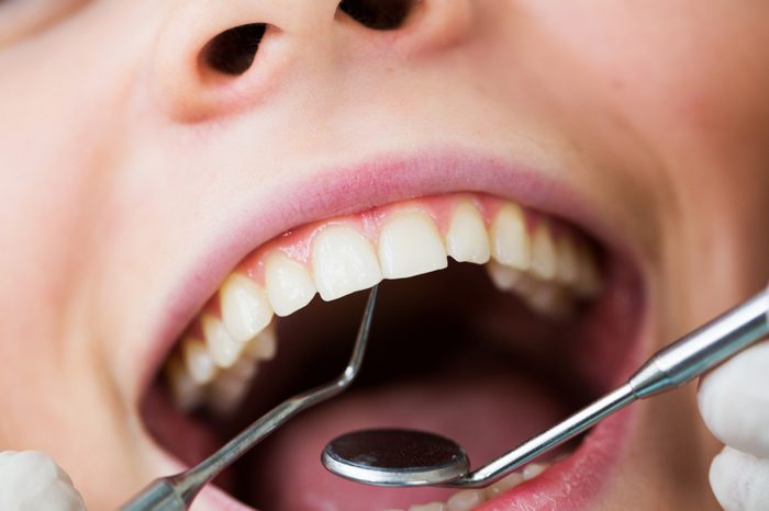 Close-up of female with open mouth during oral checkup at the dentist.Dentist