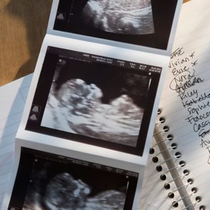 Ultrasound images lie on a wooden table beside a notebook listing potential baby names, some names crossed out or starred for emphasis.