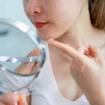 A person examines their chin using a small mirror, pointing at blemishes, in a bright room.