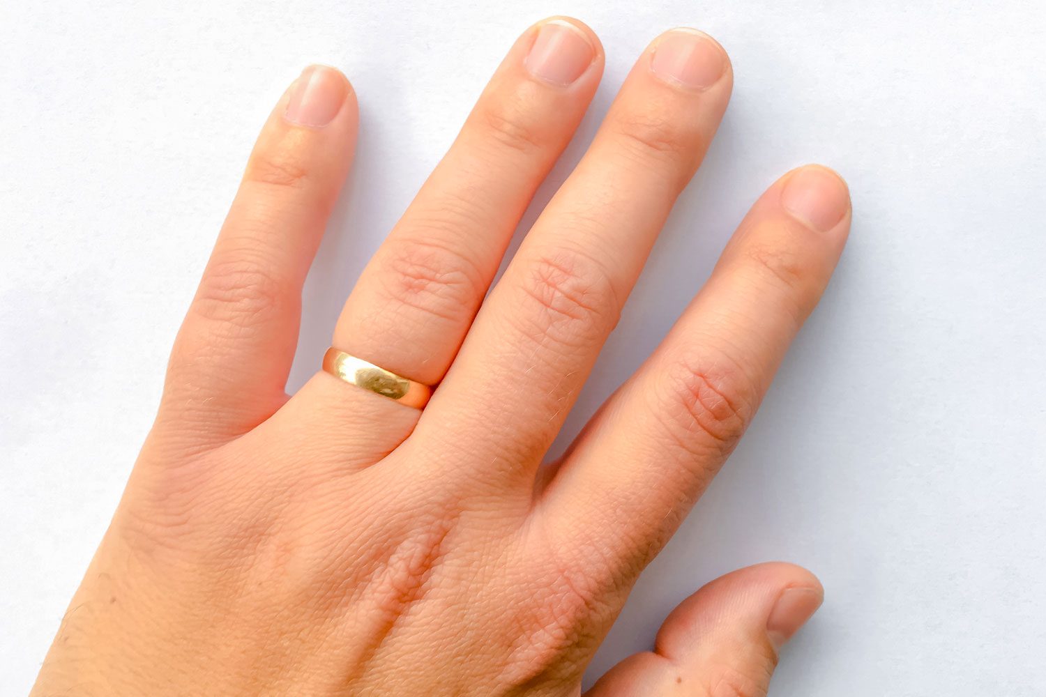 I Tried the TikTok Hack to Get a Ring Off a Swollen Finger to See If It Really Works