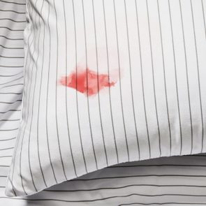 A pillow with red stain lies on striped sheets, creating a contrasting pattern in a bedroom setting.